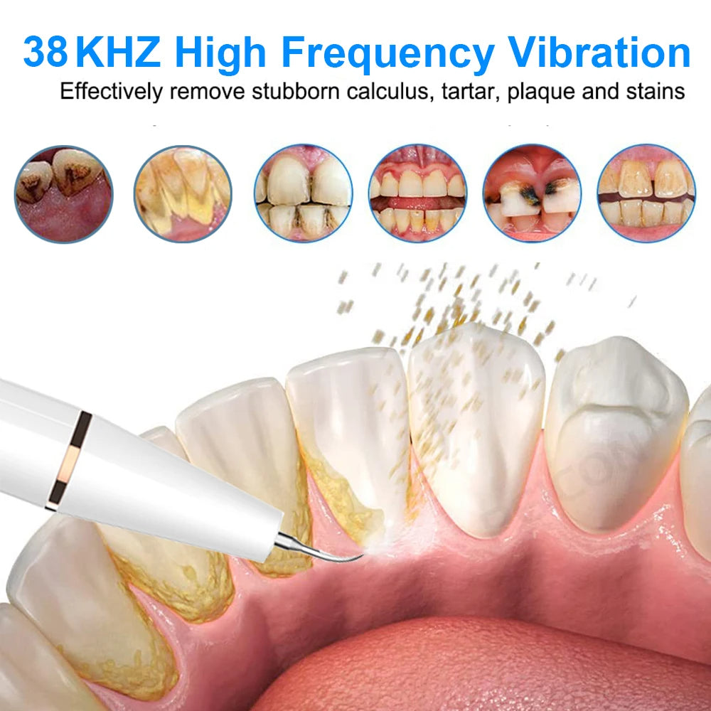 Say Goodbye to Plaque – Dentist-Level Cleaning at Home