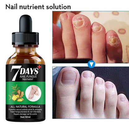 Foot Nail Fungus Treatment Serum – Clear Nails, Confident You