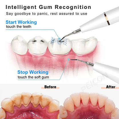 Say Goodbye to Plaque – Dentist-Level Cleaning at Home