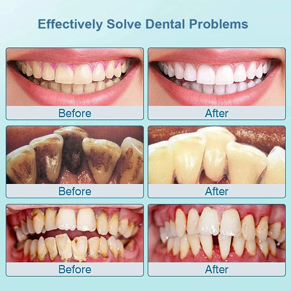 Say Goodbye to Plaque – Dentist-Level Cleaning at Home