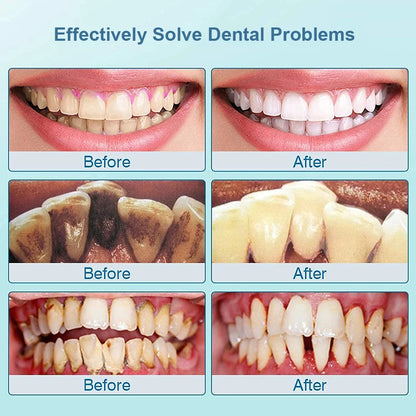 Say Goodbye to Plaque – Dentist-Level Cleaning at Home